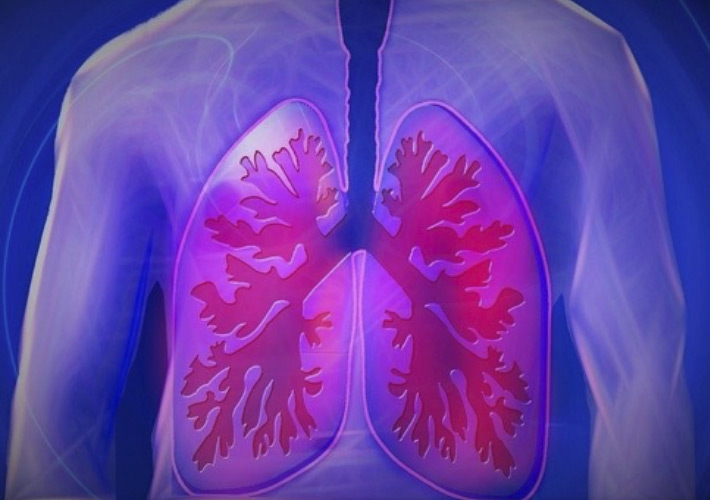 foto noticia ¿Existe relación entre el cáncer de pulmón y la mala calidad del aire en puestos de trabajo?