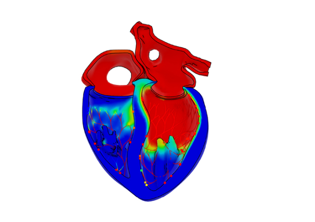 Foto Dassault Systèmes impulsa la nueva fase del Proyecto Living Heart con gemelos virtuales basados en IA.